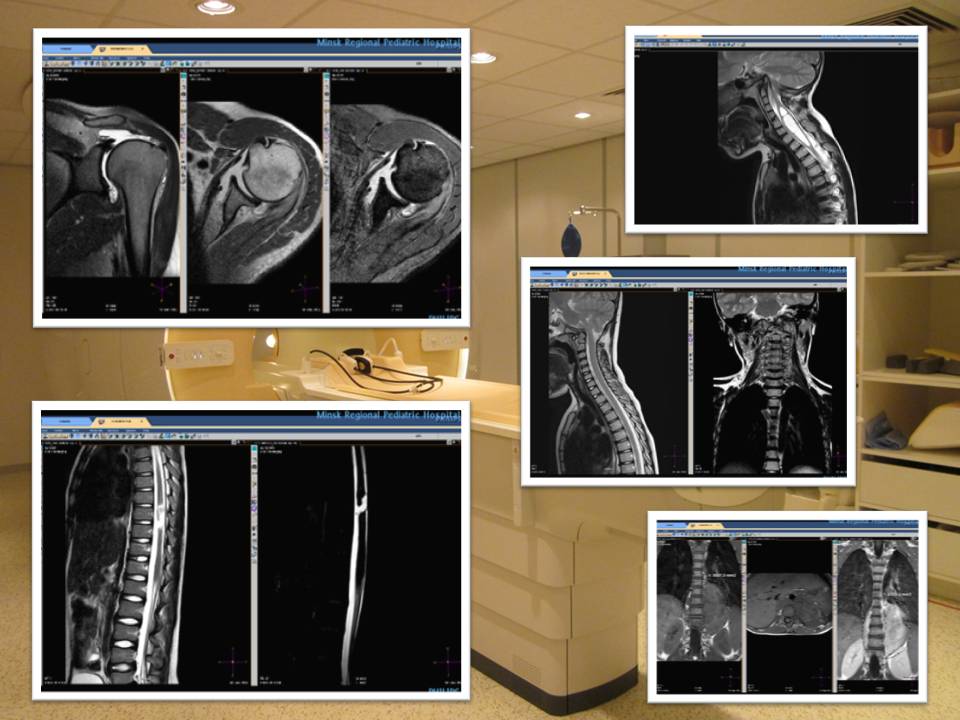 МРТ плечевого сустава в Минске: онлайн запись, цены и отзывы